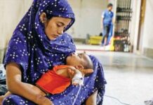 হাম ও উপসর্গে শিশুমৃত্যু সাড়ে ৫শ ছাড়ালো