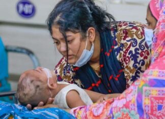 হাম ও হামের উপসর্গে আরও ১২ জনের মৃত্যু