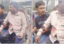মতিঝিলে ব্যবসায়ীকে গুলি করে ১৭ হাজার ডলার ছিনতাই
