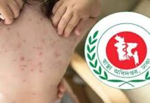 হামের উপসর্গ নিয়ে আরও ৮ শিশুর মৃত্যু