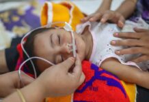 হামের উপসর্গ নিয়ে প্রাণ গেলো আরও ৫ শিশুর