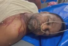 ছাতকে ব্যবসায়ীকে কুপিয়ে জখম, গ্রেপ্তার ২