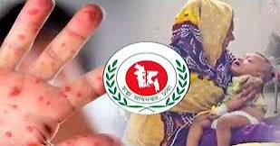 হামের উপসর্গ নিয়ে আরো তিন জনের মৃত্যু