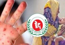 হাম ও হামের উপসর্গে আরও ৫ শিশুর মৃত্যু