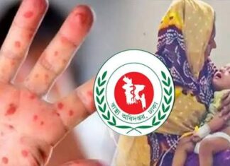 হাম ও হামের উপসর্গে আরও ৫ শিশুর মৃত্যু