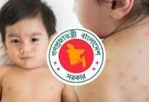 হামের উপসর্গে ৪ আরও শিশুর মৃত্যু