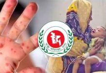 হামের উপসর্গে আরও ৫ জনের মৃত্যু