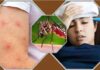 ডেঙ্গু কেড়ে নিল আরও ৬ প্রাণ, হাসপাতালে ১৪৯২