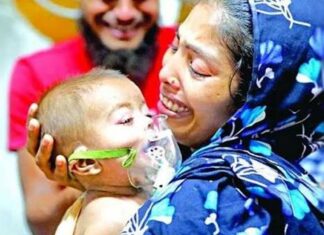 নিশ্চিত হাম ও উপসর্গে মৃত্যু ১১০০ ছাড়াল